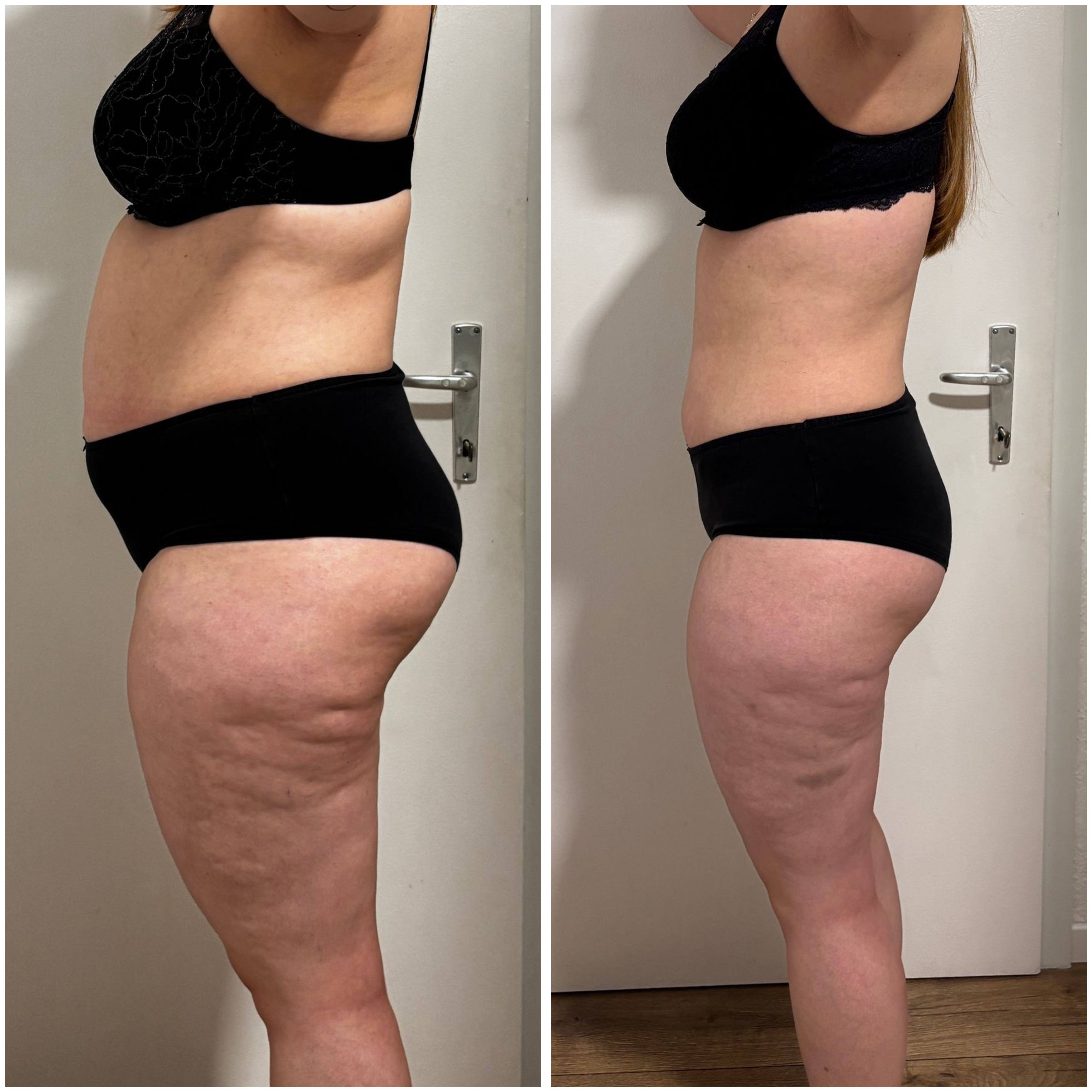 Vorher-Nachher minus 10 Kilo